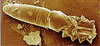 Demodex Folliculorum